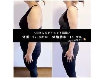 ポノフィット(PONO FIT.)/症例／全身シルエット