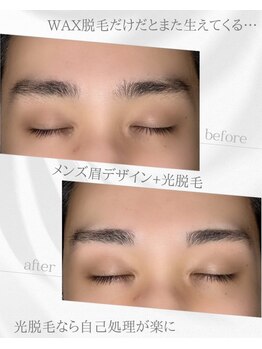 リノア(Linoa)/メンズ眉毛ビフォーアフター