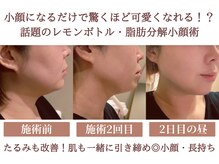 エス シークレット 金町店(S secret)