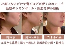 エス シークレット 金町店(S secret)