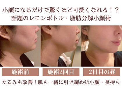 エス シークレット 金町店(S secret)の写真