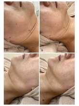 エスティ 京都店/ネオソニック