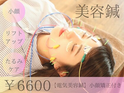 レゴリスの写真
