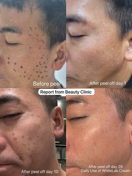 ヴィーナス 船橋駅前店(VENUS)/ホワイトラボ実例