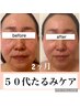【極上エラスチン導入小顔たるみフェイシャル】小顔コルギ付　¥16,500 →