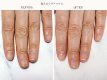 ディグニティ(Dignity)/整えるクリアネイル