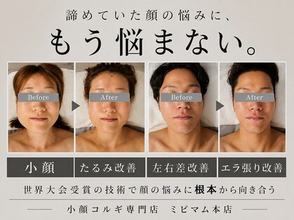 ミピマムの写真