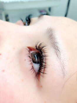 ココ シェルム(CoCo charme)/施術例