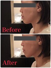 リエット(Lieto)/小顔になれます！！