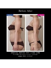 レクリエイター(Re:QREATOR)/セルフエステ(before after)