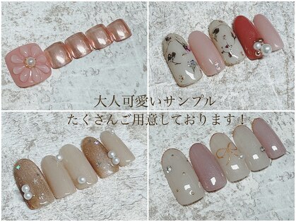 フランセス(Frances)の写真