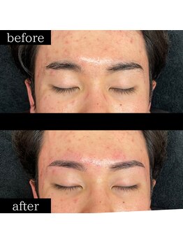 ユー 千葉駅前店(you)/メンズ眉毛/メンズ眉/千葉駅