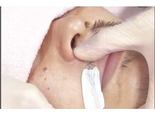 ジェンティル(Gentil)の雰囲気（メンズ脱毛☆WAX脱毛でお肌トラブル改善！ツルツル美肌に自信！）