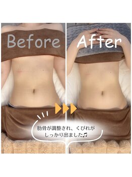 スリモア(SLIMORE)/ビフォーアフター☆お腹