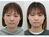 【学割U24】小顔・顔の歪み矯正 根本から歪みをリセット!¥12,800⇒¥2,980