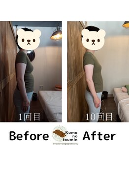 クマの冬眠 高知店/産後ケアでスッキリ