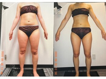 パーフェクトボディプレミアム 名古屋駅前店(PERFECT BODY PREMIUM)/お客様　ビフォーアフター（33）