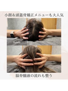 サロン リヒカ(Salon Rihica)/頭蓋骨矯正で頭もスッキリ