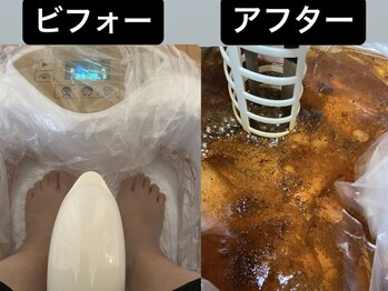 ヒヨリ(hiyori)/ゴットクリーナー