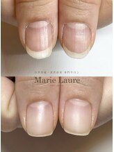マリーロール 天王寺店(Marie Laure)/自爪育成/深爪矯正/ネイルケア