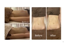 レーヴ(Reve)/くびれ形成/痩身/バストアップ