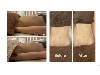 レーヴ(Reve)/くびれ形成/痩身/バストアップ