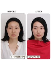 シュアリー(Surely)/トータルコースお客様事例