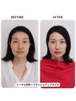 シュアリー(Surely)/トータルコースお客様事例