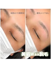 プリムス(Primus)/美眉Wax脱毛