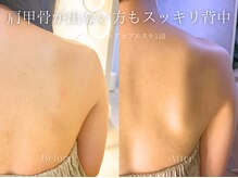 エメ(Aimee)/ブライダルエステ