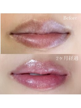 リラ(Lyra)/ローマピンク