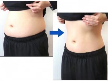 ヨサパーク ナツキ 西大宮(YOSA PARK natsuki)/ビフォーアフター