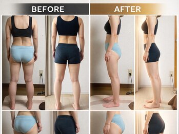 ティーラボ(T-LABO)/３０代女性姿勢改善で美ボディに