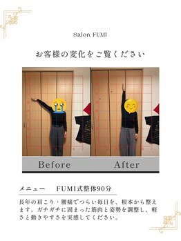 フミ(FUMI)/ 40代女性 施術事例【姿勢矯正】