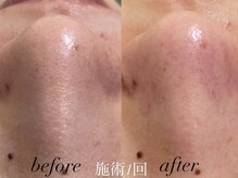 リスポアラボ(LIS PORE.LAB)/