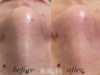 リスポアラボ(LIS PORE.LAB)/