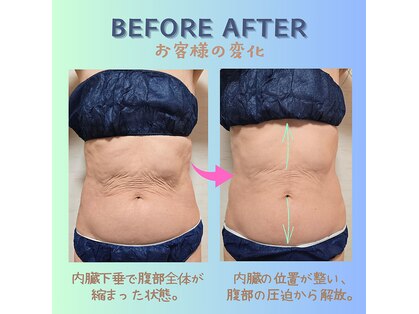 エラフリーの写真