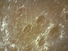 ピュリフィケーション(Purification)/普段は見えない毛穴の中や肌表面