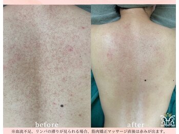 スリジエ ボーテ(cerisierBEAUTE)の写真/感動のリピ率95%超え!肌悩み全解決《Lv4ハ-ブピ-リング最大量34000円》ハリ艶UPで透き通る様な陶肌体験を◎