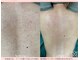 スリジエ ボーテ(cerisierBEAUTE)の写真/感動のリピ率95%超え!肌悩み全解決《Lv4ハ-ブピ-リング最大量34000円》ハリ艶UPで透き通る様な陶肌体験を◎