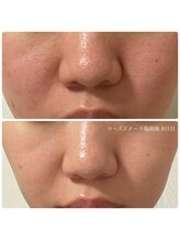 エクラ(eclat)/クリスティーナ