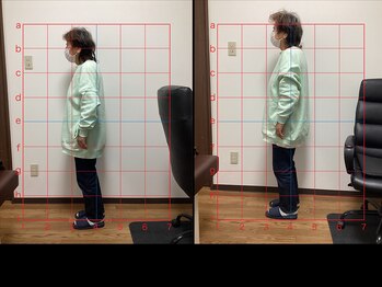 サンキュー鍼灸院整体院/姿勢改善も得意です。