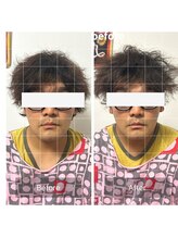 ダンニヒル(dannihil)/小顔矯正