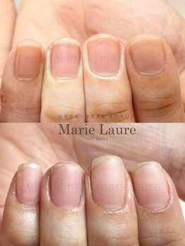 マリーロール 淀屋橋本店(Marie Laure)/自爪育成/深爪矯正/ネイルケア