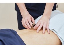 高田馬場名倉堂鍼灸接骨院/鍼施術