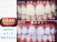 シャイニー 掛川店(shiny)