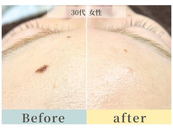 ムク(Muqu.)/一目瞭然のツルんとした額！