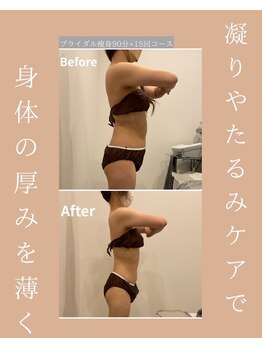 メゾンワン(maison one)/挙式前ボディ改革
