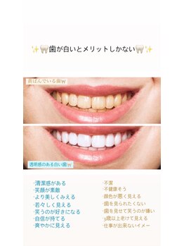 セルフホワイトニングサロン　エクシアホワイトニング宇治小倉店/ビフォーアフター