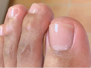 ランカ(RUNKA)/ツヤのある自爪へ